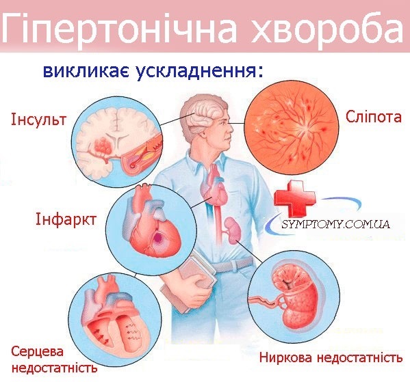 Гіпертонічна хвороба