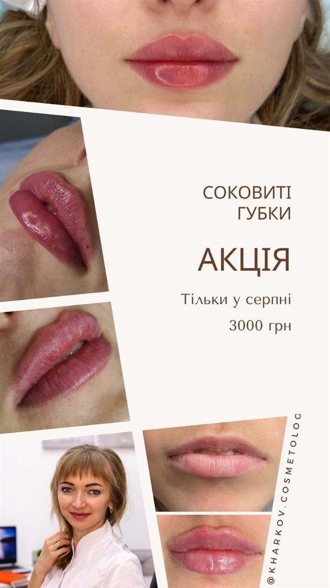 Акція від косметологині Аліни Костричук